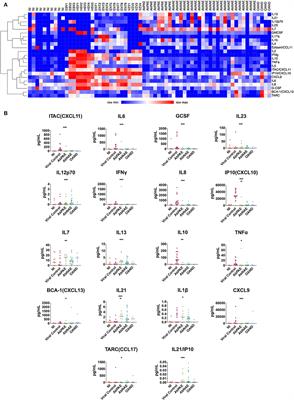 Novel Surrogate Markers of CNS Inflammation in CSF in the Diagnosis of Autoimmune Encephalitis